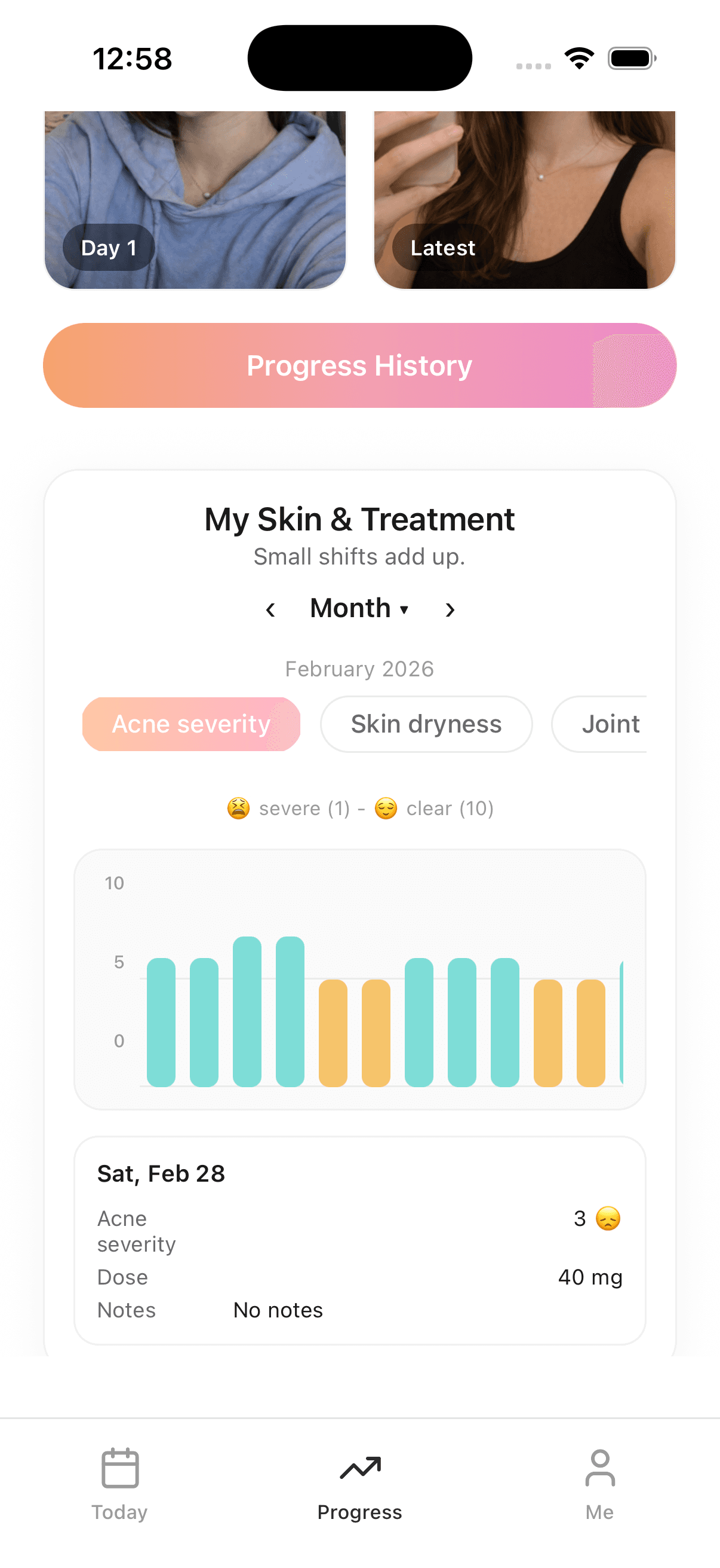 Cleyra skin & treatment chart — monthly acne severity view