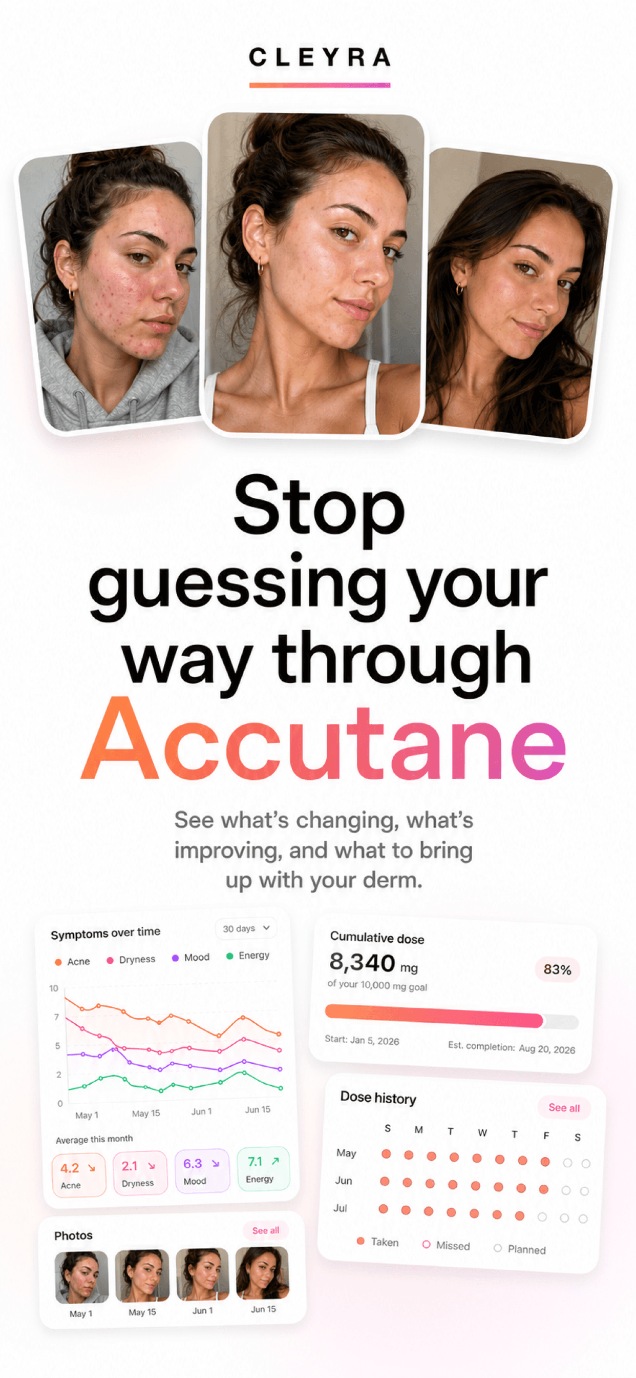 Stop guessing your way through Accutane — Cleyra symptom charts, cumulative dose, and progress photos