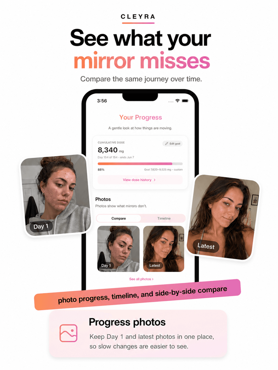 See what your mirror misses — compare Day 1 and latest progress photos in Cleyra