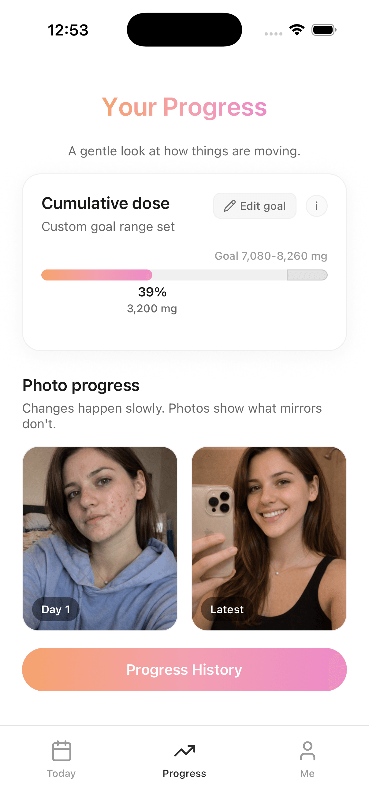 Cleyra progress screen — cumulative dose and photo timeline